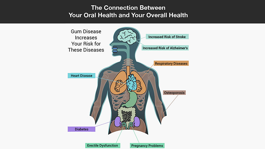 The Connection Between Your Oral Health and Your Overall Health 1920x1080 1