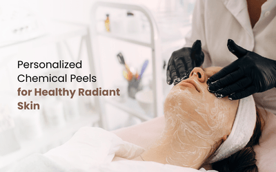 chemical peels treatment